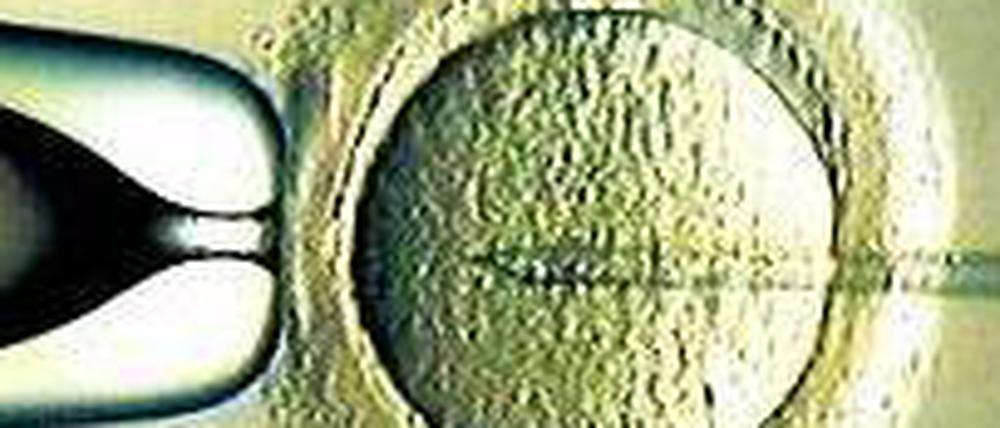Künstlich befruchtet. Forscher testen neue Verfahren. 