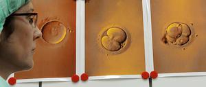 Schon vor der Geburt eines Kindes können Mediziner heute viel über seine Gesundheit sagen. Ob sie das auch immer sollen, ist umstritten.