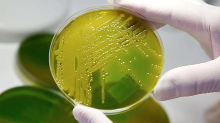 Multiresistente Keime können vor allem Säuglingen und Senioren gefährlich werden.