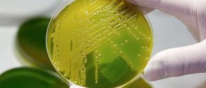 Multiresistente Keime können vor allem Säuglingen und Senioren gefährlich werden.