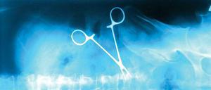 Vergisst der Chirurg die OP-Klemme im Bauch, ist das ein klarer Kunstfehler. Doch nicht immer lässt sich die Schuld des Arztes so einfach nachweisen. 