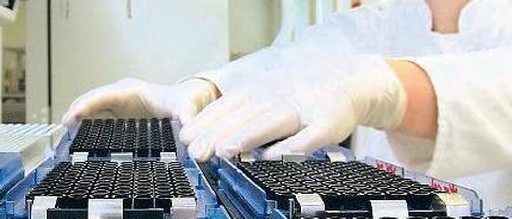 Biotech in Berlin. Auch das Unternehmen Epigenomics spürt, dass die Geldgeber zurückhaltender sind. Die Firma produziert Tests zur Früherkennung von Krebs. 
