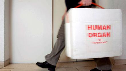 Die Deutsche Stiftung für Organtransplantation reformiert sich.