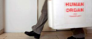 Die Deutsche Stiftung für Organtransplantation reformiert sich.