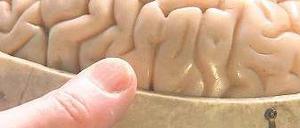 In welchen Untiefen des menschlichen Gehirns sitzt das Böse? Foto: Arte