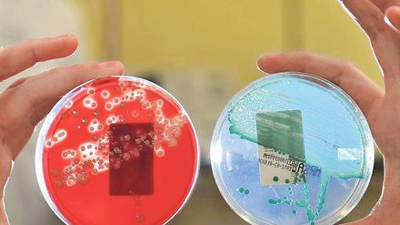 Im Visier. Der resistente Krankenhauskeim MRSA verursacht weltweit 1,5 Millionen Infektionen jährlich. Während sich Menschen bis vor einigen Jahren nur in Kliniken damit ansteckten, kann das inzwischen auch im alltäglichen Umfeld passieren.