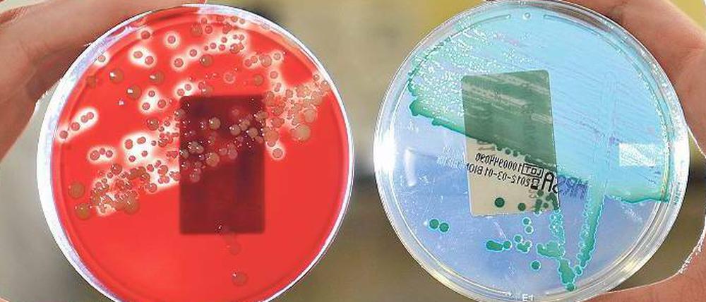 Im Visier. Der resistente Krankenhauskeim MRSA verursacht weltweit 1,5 Millionen Infektionen jährlich. Während sich Menschen bis vor einigen Jahren nur in Kliniken damit ansteckten, kann das inzwischen auch im alltäglichen Umfeld passieren. 