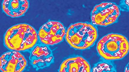 Im Visier der Forscher. Aidsviren unter dem Elektronenmikroskop.