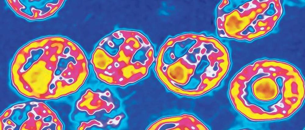 Im Visier der Forscher. Aidsviren unter dem Elektronenmikroskop.