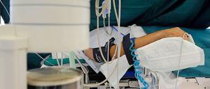 Die Ärzteschaft will das Vertrauen in die Transplantationsmedizin wiederherstellen.