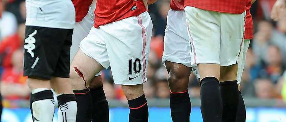 Schmerzhaft. Wayne Rooney mit einer klaffenden Wunde am Oberschenkel.