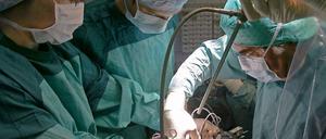 Mit seinen Berechnungen befördert Harald Terpe (Grüne) das Misstrauen in das Organspendesystem stärker als jeder überführte Betrüger im Doktorkittel.