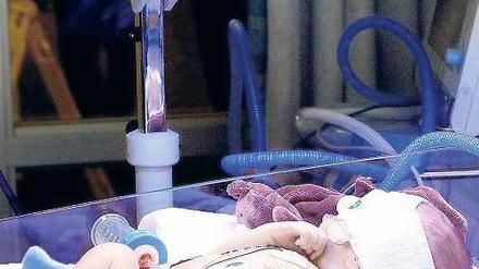 Schwerer Start. Jedes 20. Baby muss auf die Intensivstation.