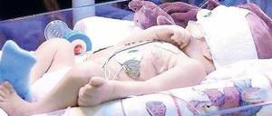 Schwerer Start. Jedes 20. Baby muss auf die Intensivstation. 