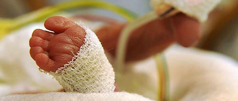 Frühchen bedürfen besonders intensiver Behandlung.