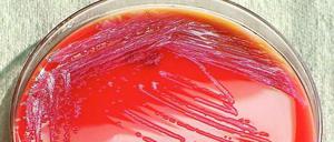 Serratia marcescens, der Keim, der in der Charité gefunden wurde, in eine Petri-Schale gezüchtet. 