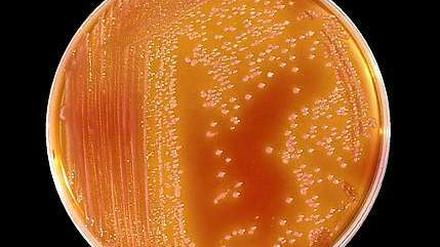 Serratia marcescens ist ein Keim, der überall vorkommt. 