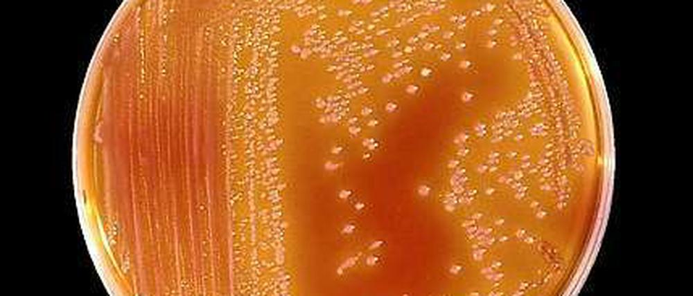 Serratia marcescens ist ein Keim, der überall vorkommt. 