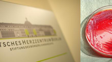 Auch das Herzzentrum steht nun in der Kritik, weil meldepflichtige Serratien-Infektionen verschwiegen worden sein sollen.