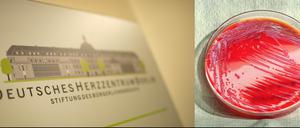 Auch das Herzzentrum steht nun in der Kritik, weil meldepflichtige Serratien-Infektionen verschwiegen worden sein sollen.