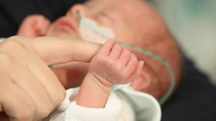 Transparenz kann Berliner Kliniken helfen, verloren gegangenes Vertrauen in ihre Arbeit mit Frühgeborenen zurückzugewinnen.
