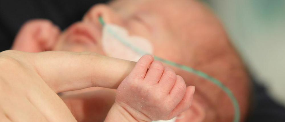 Transparenz kann Berliner Kliniken helfen, verloren gegangenes Vertrauen in ihre Arbeit mit Frühgeborenen zurückzugewinnen.