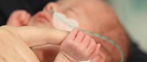 Transparenz kann Berliner Kliniken helfen, verloren gegangenes Vertrauen in ihre Arbeit mit Frühgeborenen zurückzugewinnen.