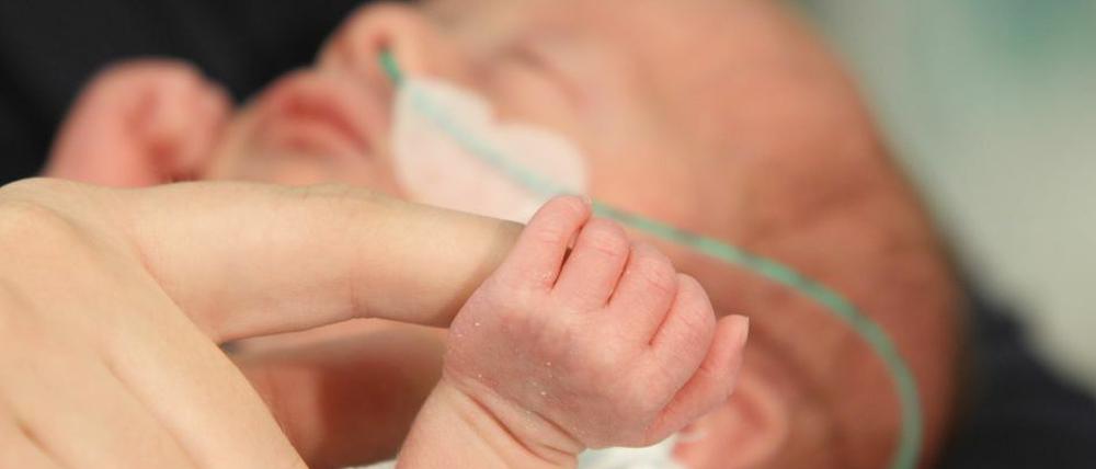 Transparenz kann Berliner Kliniken helfen, verloren gegangenes Vertrauen in ihre Arbeit mit Frühgeborenen zurückzugewinnen.