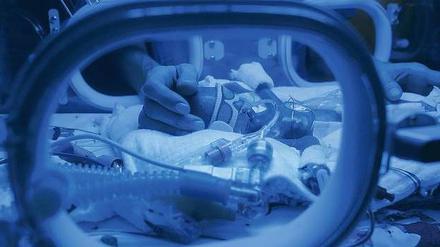 Sind die Hände sauber? In der Charité wurden Keime auf mehr als 20 getrennt in Brutkästen liegende Frühchen übertragen. Das ist lebensgefährlich für die Babys.