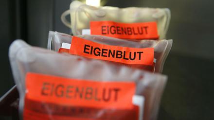 Eigenblut sieht gut aus, macht Spaß und schmeckt nach Erdbeerbrause. Die Freigabe des Dopings könnte so ganze Wirtschaftszweige beleben.
