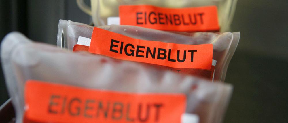 Eigenblut sieht gut aus, macht Spaß und schmeckt nach Erdbeerbrause. Die Freigabe des Dopings könnte so ganze Wirtschaftszweige beleben.