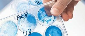 Umstrittene Grundlagenforschung. Wer Impfungen oder Gegenmittel gegen die Vogelgrippe entwickeln will, muss die Viren erst verstehen.