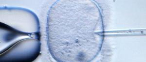 Der Bundesrat stimmte einer entsprechenden Rechtsverordnung zu.