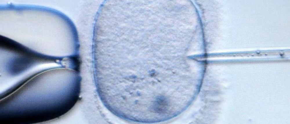 Umstrittenes Thema: Präimplantationsdiagnostik (PID).