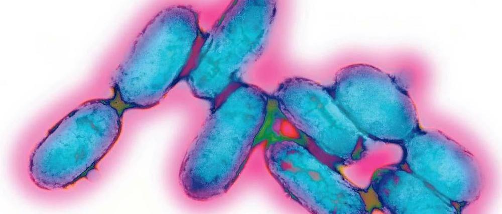 Große Gefahr. Der Erreger Yersinia pestis hat vermutlich mehr als 200 Millionen Menschen getötet.