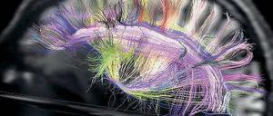 Elegantes Gehirn. Nervenbahnen sind keine wirren Knäuel. Sie verlaufen parallel und bilden ordentliche 3-D-Gitter. 