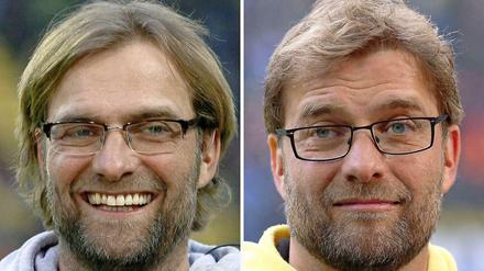 Das Haarwunder des Jürgen Klopp: vorher - nachher. 