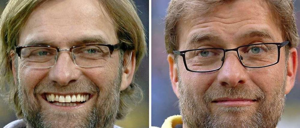 Das Haarwunder des Jürgen Klopp: vorher - nachher. 