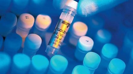 Biotechunternehmen warten vielfach immer noch auf den großen Durchbruch.