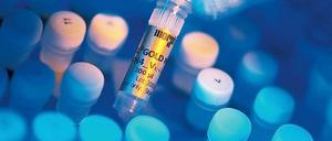 Biotechunternehmen warten vielfach immer noch auf den großen Durchbruch.