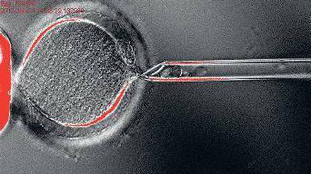 Entkernt. Im ersten Schritt entfernten die Forscher den Kern aus einer menschlichen Eizelle. In diese brachten sie dann den Kern einer Hautzelle. Daraus entwickelte sich schließlich ein Embryo.