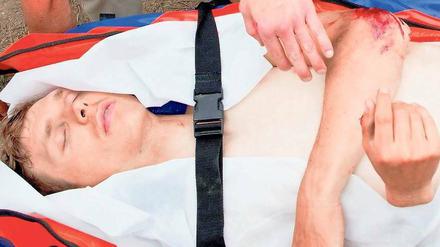 Tour der Leiden. Tony Martin stürzte auf der ersten Etappe schwer. Foto: AFP
