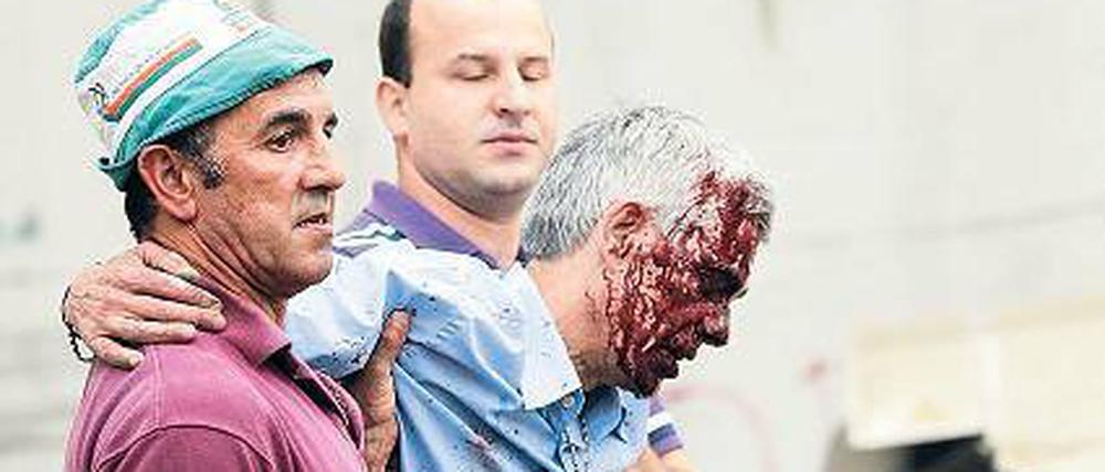 Blutüberströmt. Lokführer Francisco Jose G. nach dem Unglück.