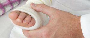 Mädchen mit gebrochenem Bein