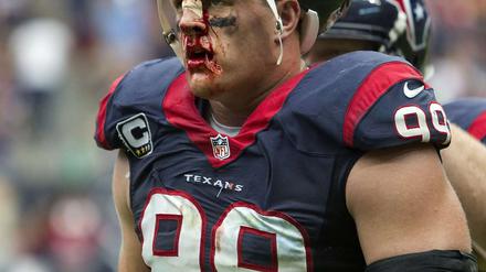 Harter Einsatz. JJ Watt.