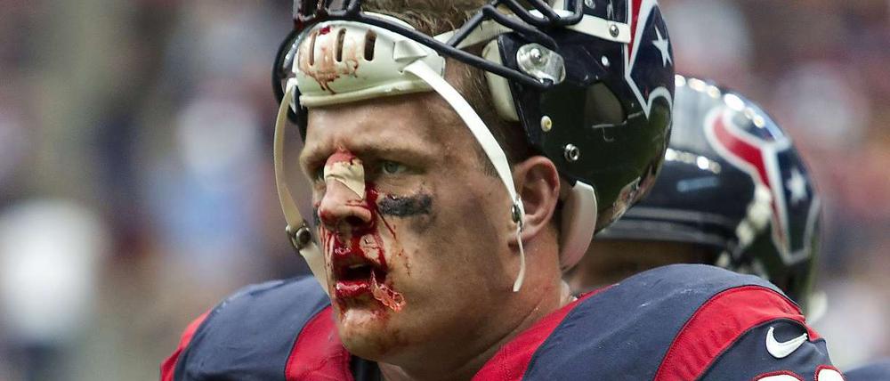 Harter Einsatz. JJ Watt.