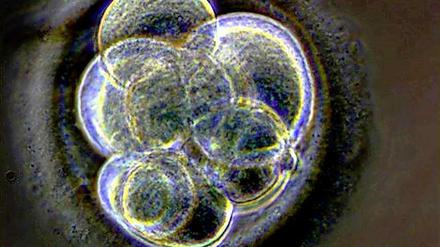 Ein wenige Tage alter Embryo. Das Geschlecht prägt sich erst später aus.
