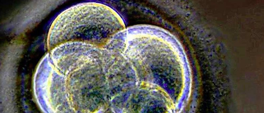 Ein wenige Tage alter Embryo. Das Geschlecht prägt sich erst später aus.