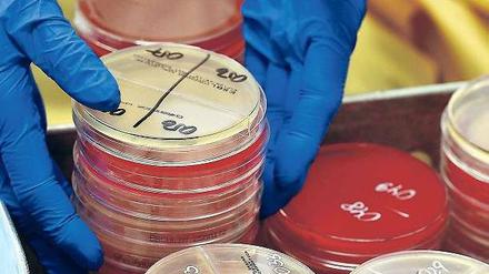 Hartnäckig. Das Uniklinikum Leipzig kämpfte jahrelang mit einem multiresistenten Keim namens KPC. 2010 hatte ihn ein griechischer Patient eingeschleppt. Insgesamt steckten sich bei dem Ausbruch mehr als 100 Patienten an. 