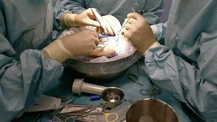 Viel zu wenig: Die Zahl der Organspenden in Deutschland geht weiter zurück.
